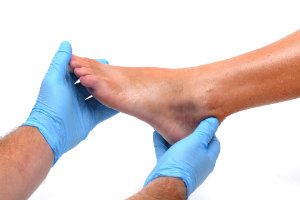 Ankle Fracture Examination